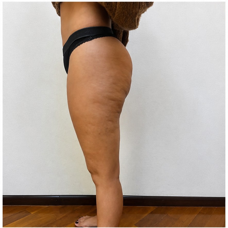 Before treatment